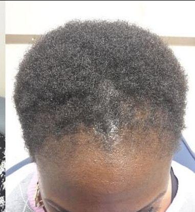 Before transformation