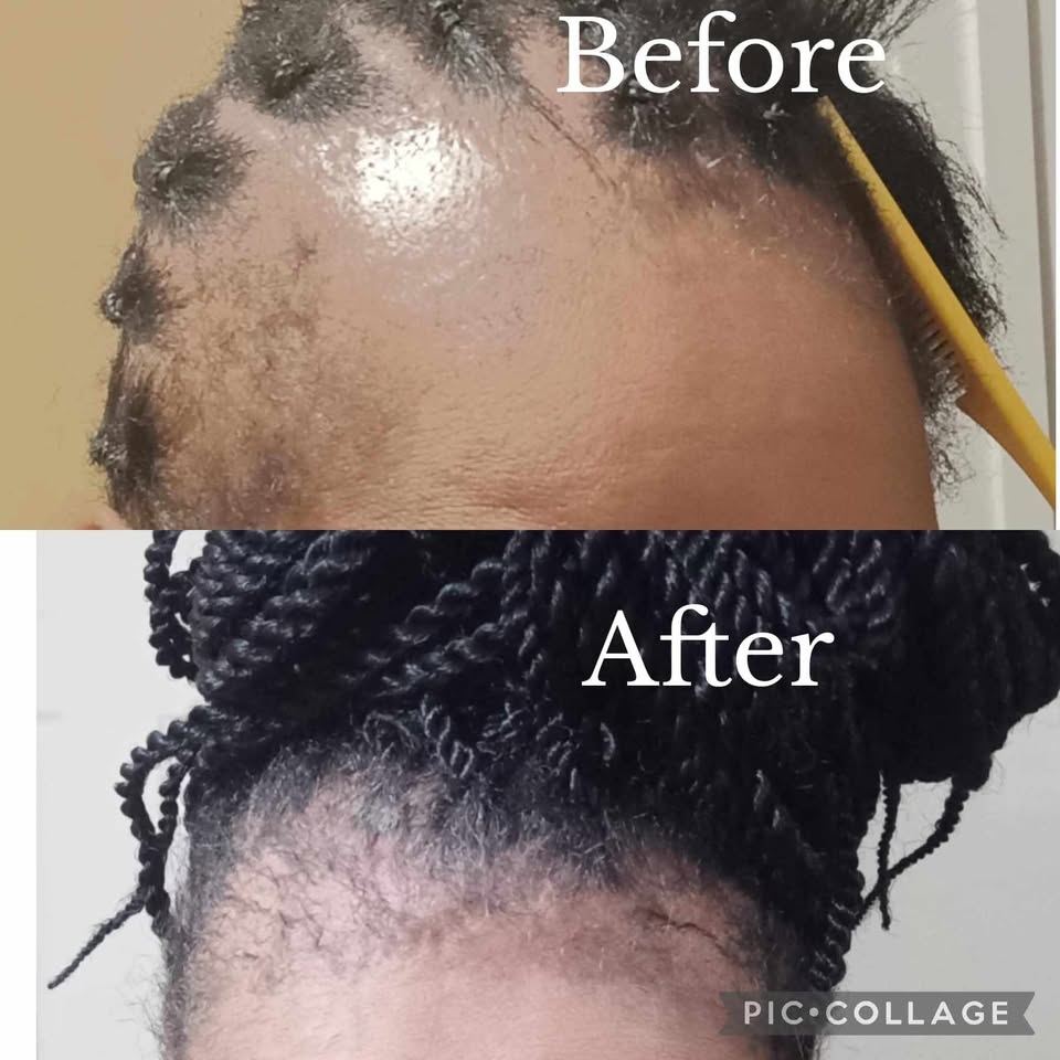 Hair Growth Shampoo