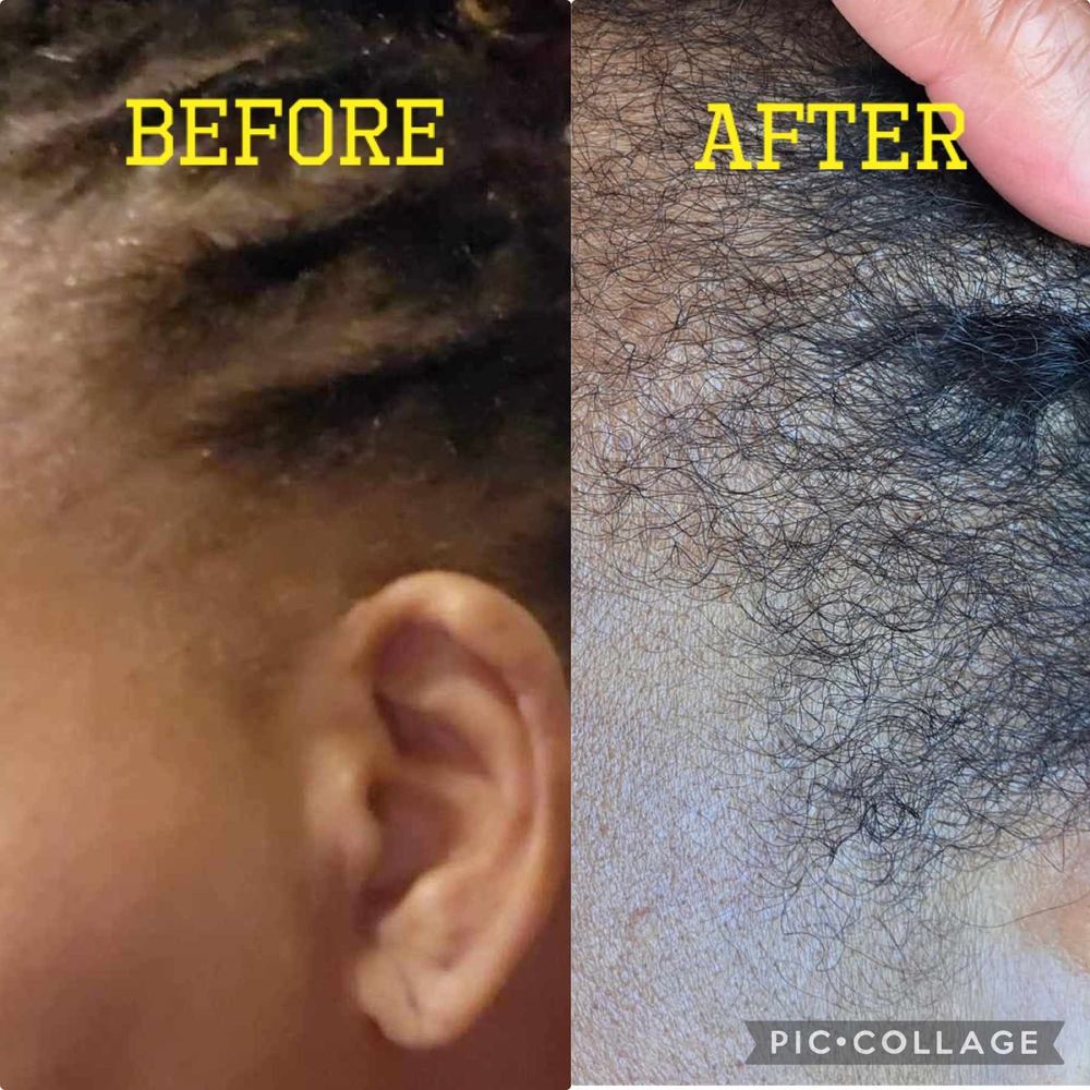 Hair Growth Oil